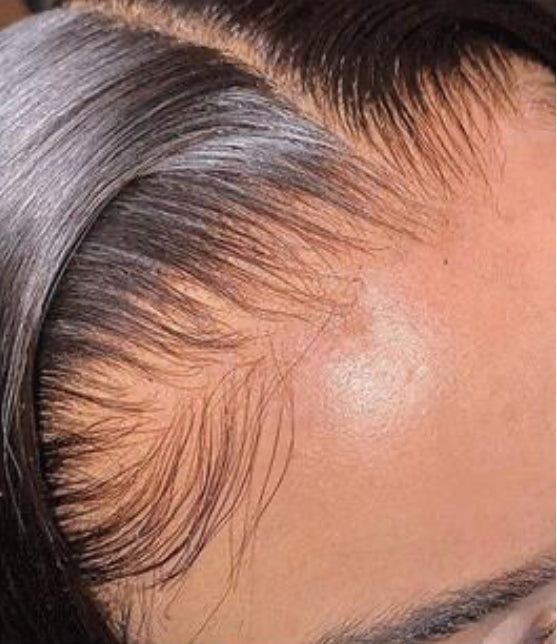 Loose Deepwave Frontal